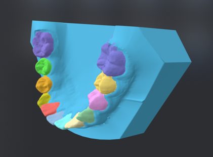 Dental image analysis