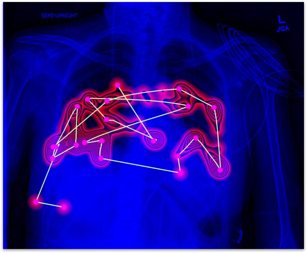 Eye-tracking in radiology