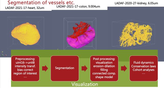 Processing of larger than memory images